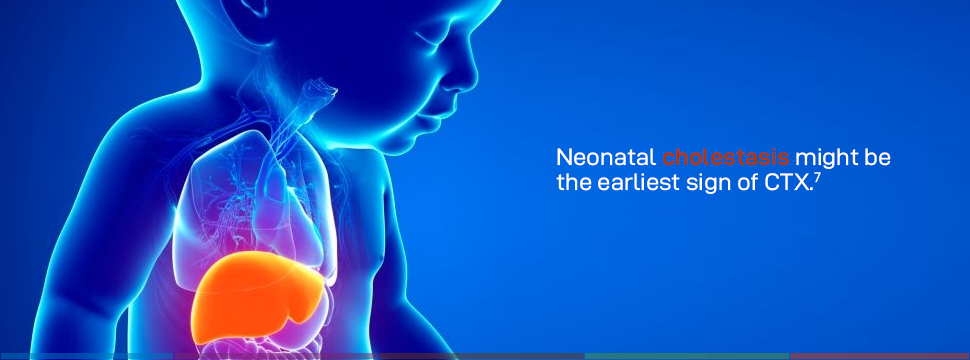 Neonatal cholestasis might be the earliest sign of CTX.